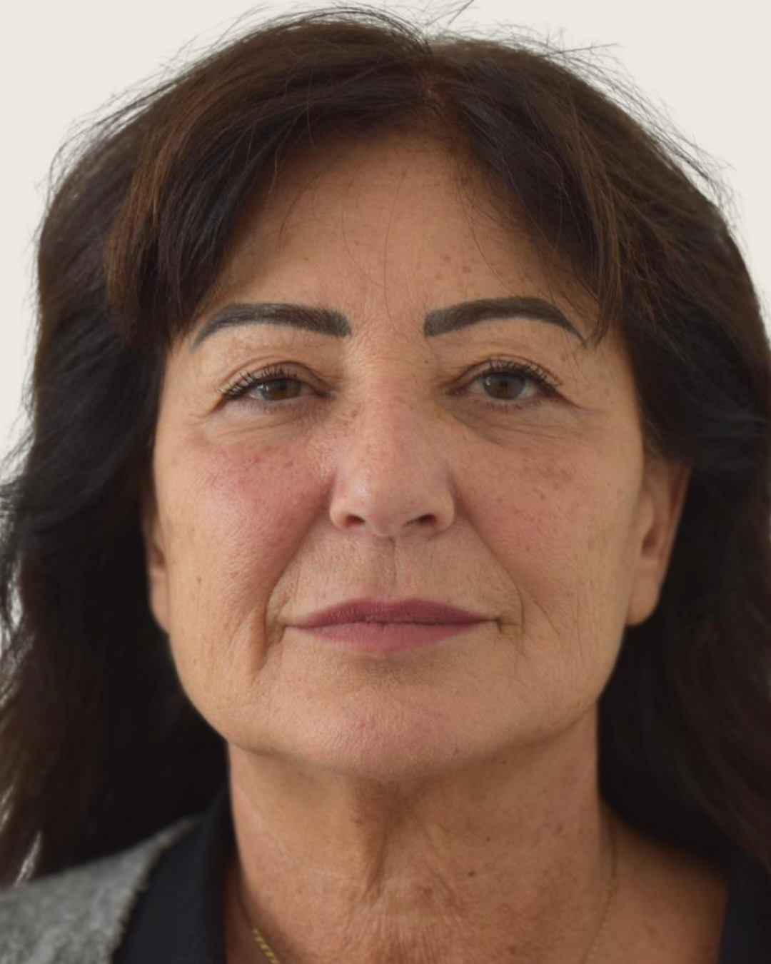 Prima - Bioristrutturazione