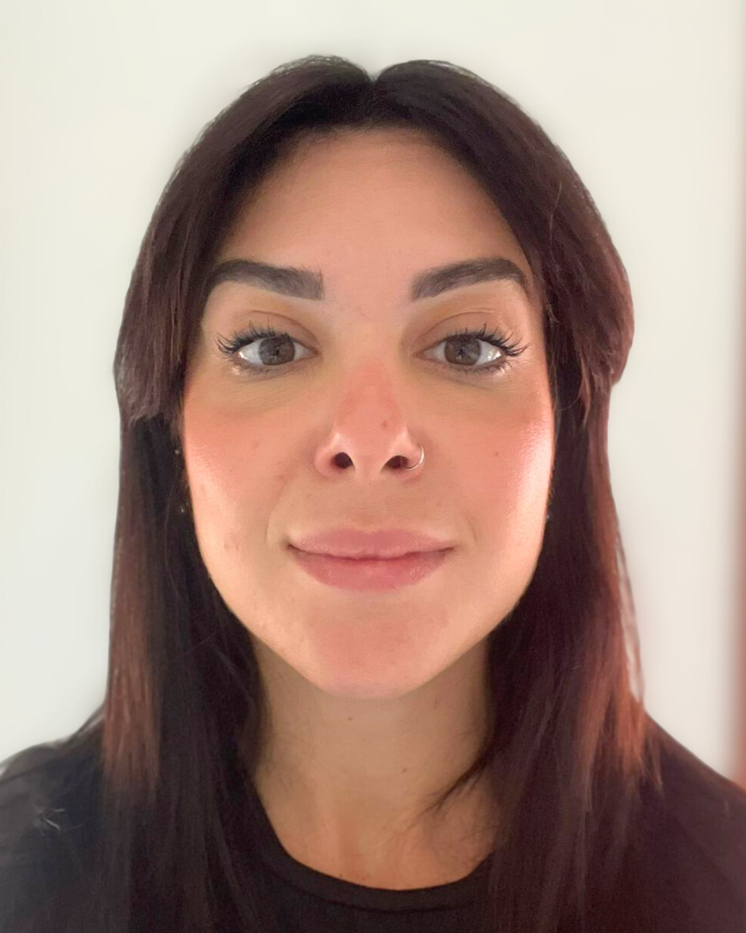 Dopo - Radiofrequenza PRX